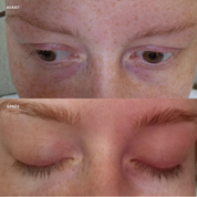 LASH SERUM
