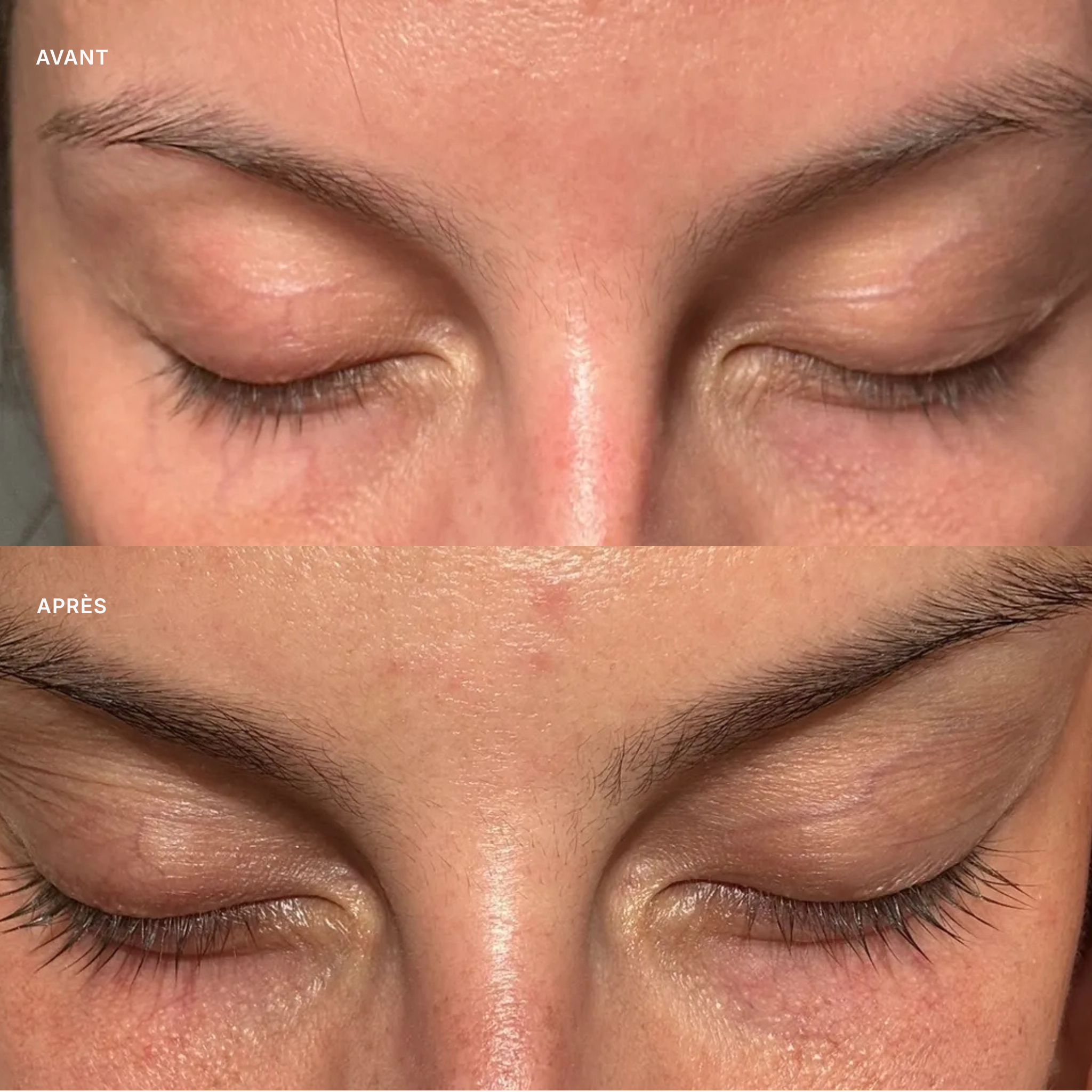 LASH SERUM